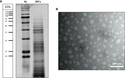 The synergistic effect of Levilactobacillus brevis IBRC-M10790 and vitamin D3 on Helicobacter pylori-induced inflammation